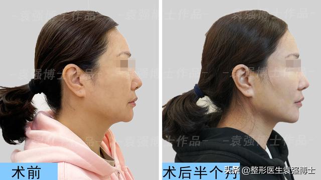 抗衰医美项目有哪些（抗衰医美项目小红书）