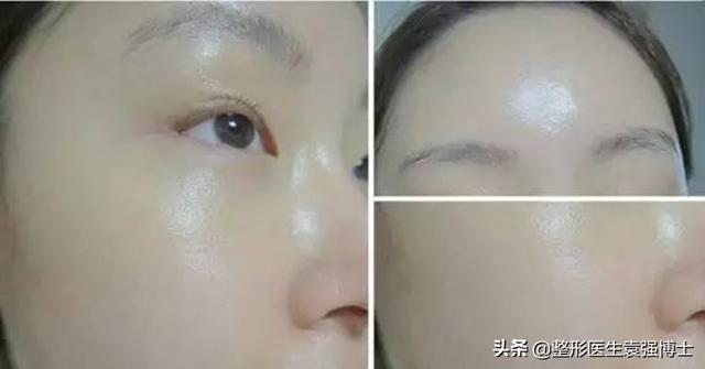 抗衰医美项目有哪些（抗衰医美项目小红书）