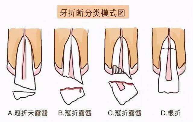 表示牙痛的朋友圈图片，牙疼发朋友圈配图_痛苦