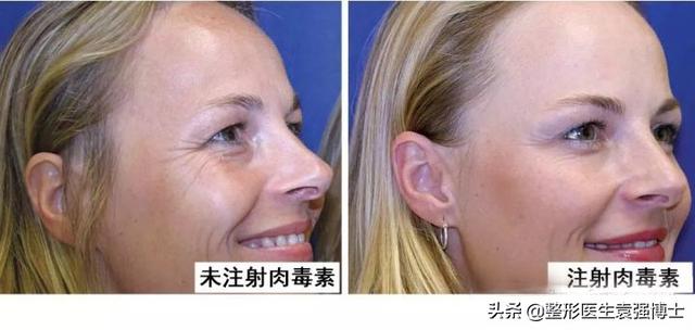抗衰医美项目有哪些（抗衰医美项目小红书）