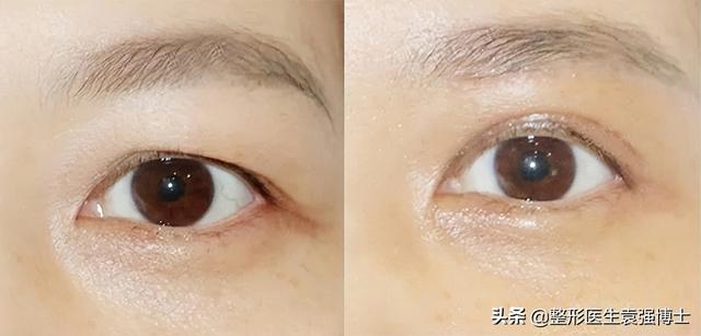 抗衰医美项目有哪些（抗衰医美项目小红书）