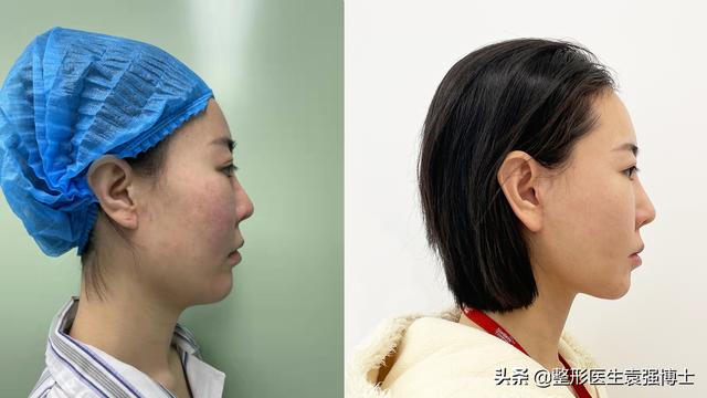 抗衰医美项目有哪些（抗衰医美项目小红书）